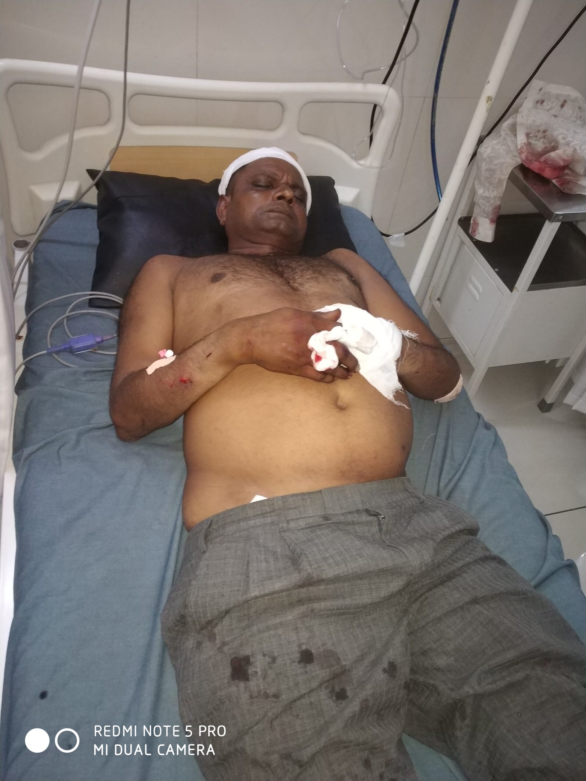 Gondal-ગોંડલ તાલુકા નાં મોવિયા ગામે પટેલ અને ભરવાડ ને છાણ ના ખાતર બારામાં ખાટું પડતા મારા મારીમાં પટેલ યુવાન ઘાયલ.