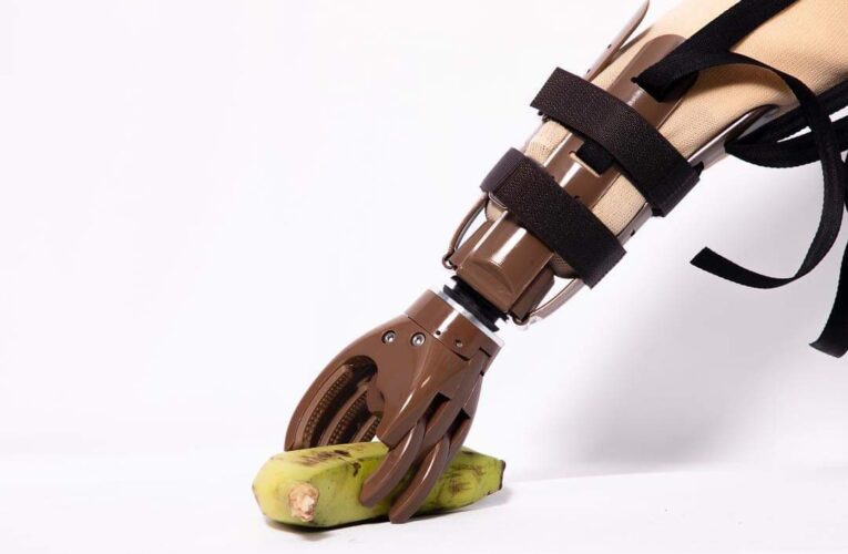 Halvad-Morbi રોટરી કલબ ઓફ હળવદ દ્વારા વિનામૂલ્યે કુત્રિમ હાથ ફિટિંગ કેમ્પનું આયોજન.