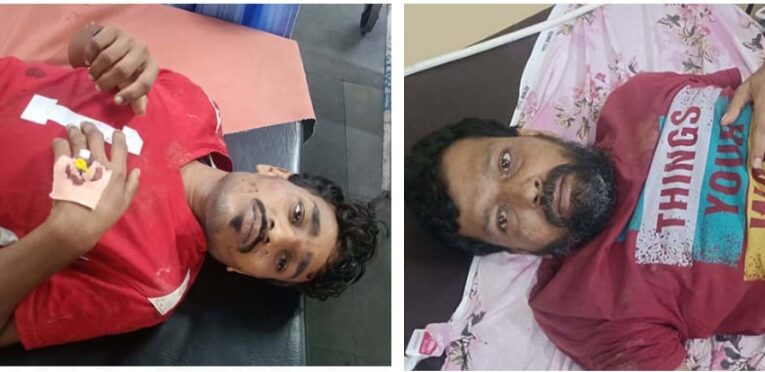 ગોંડલની સબ જેલમાં રહેલા બે કાચા કામના કેદીઓએ એક સાથે એસિડ ગટગટાવતા તંત્રમાં દોડધામ મચી જવા પામી.